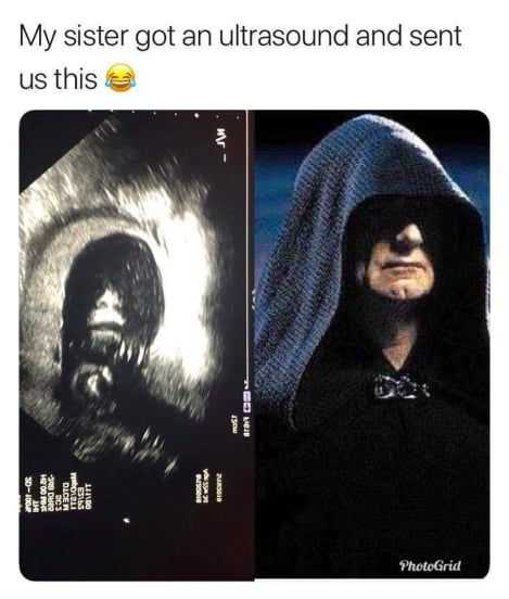 Funny Sister Ultrasound