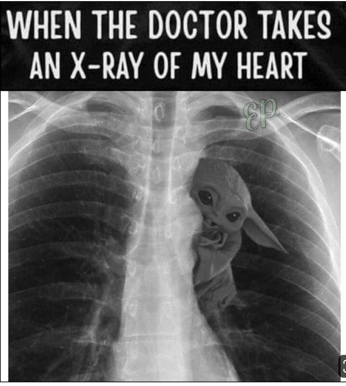 Yoda-Ex-Ray Yoda Ex Ray