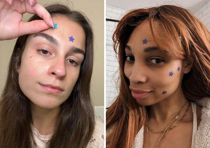 66Fcef3Fd2Cbb Star Pimple Patches
