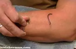 Guy Sticks 4 Fish Hooks Into His Arm To Demonstrate How To Remove A Fish Hook Featured