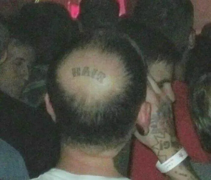 30 Hideous Pictures That Will Make You Cringe