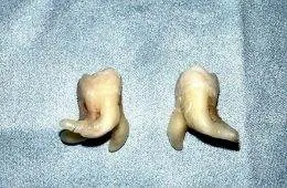 66Abdcd7F2Fa3 524Alw1Vx1Gd1 Jpeg 700