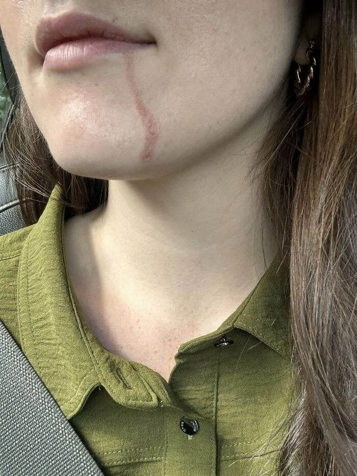 66Fa59B59C560 Xjx25Ksxzeqd1 700 1