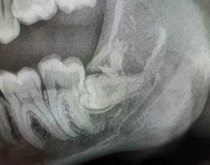 66Fb95D5F1643 People Having Really Bad Day