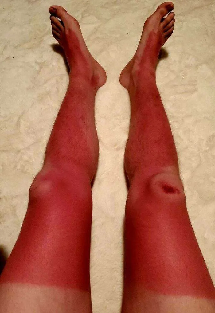 66Fe706Af2Fda People Having Really Bad Day