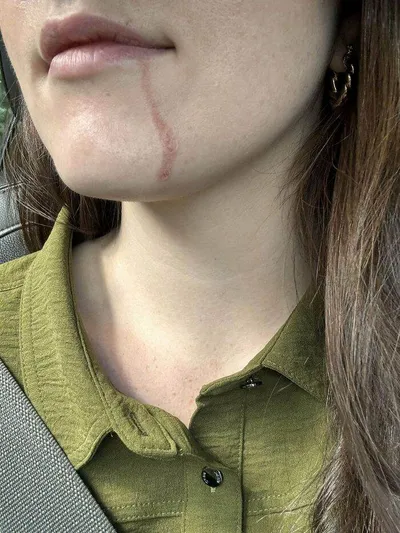 66Fa59B59C560 Xjx25Ksxzeqd1 700 1