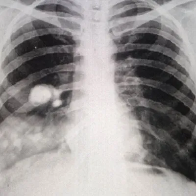 66Fa9D7022C2A P1Hygvmtxxfd1 Png 700 1