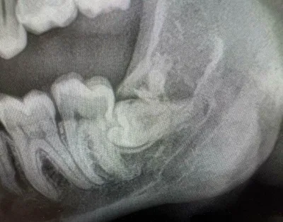 66Fb95D5F1643 People Having Really Bad Day