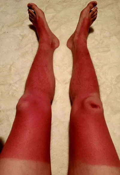 66Fe706Af2Fda People Having Really Bad Day